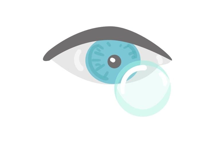 Contact Lenses Database